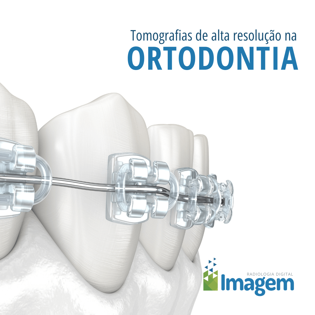 Tomografia de alta resolução na ortodontia