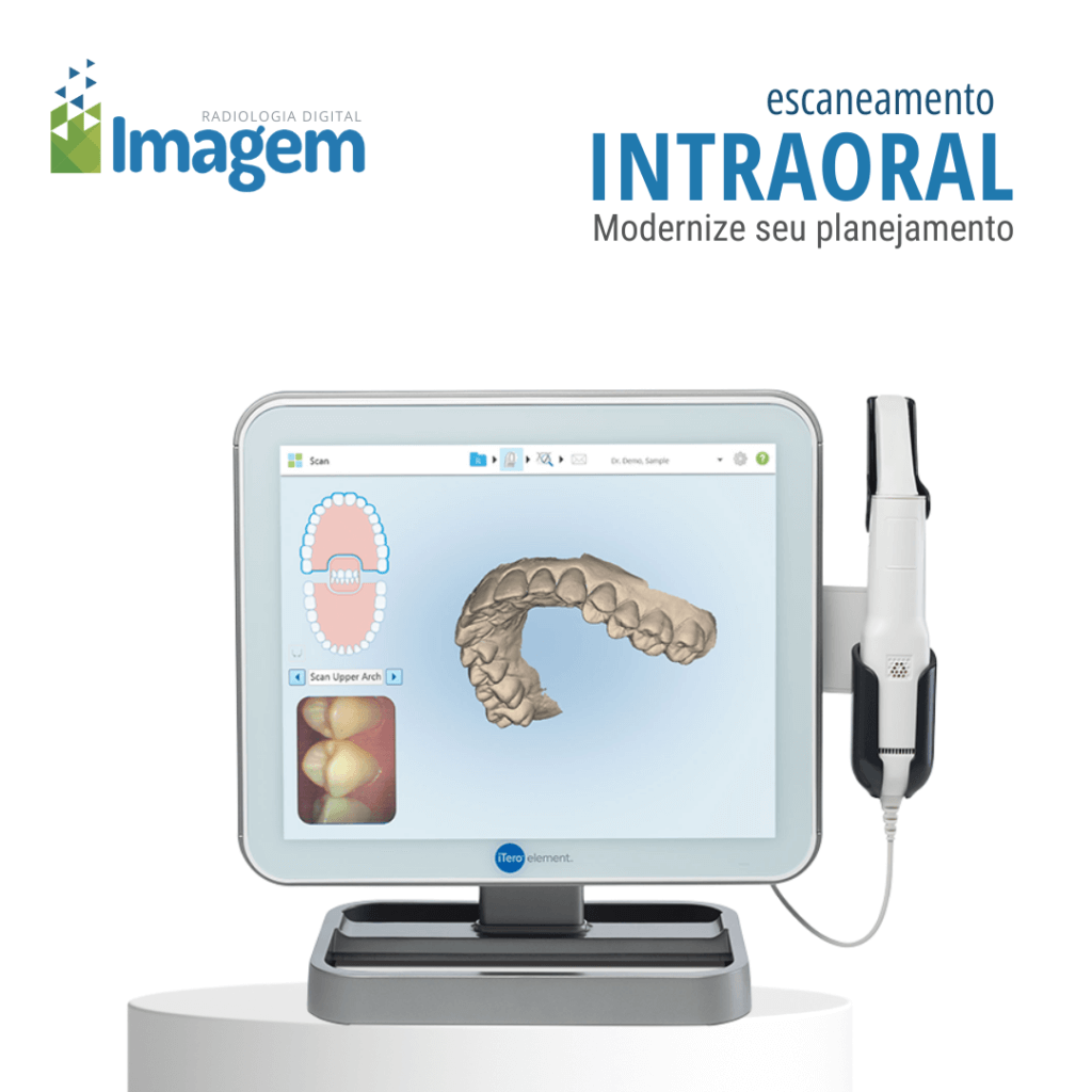Escaneamento intraoral