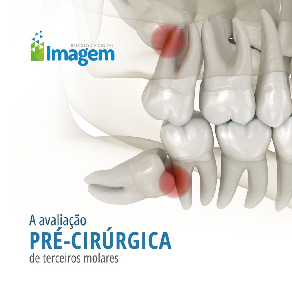 a-avalicao-pre-cirurgica