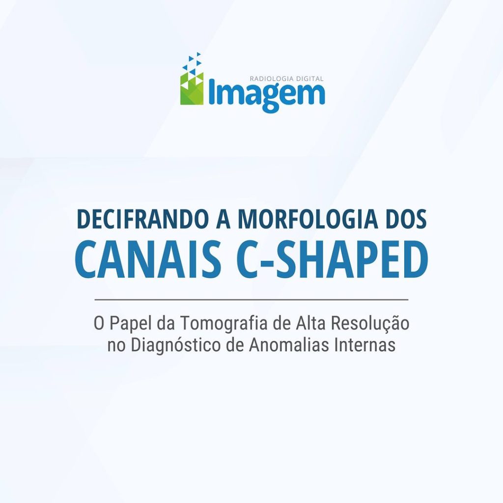 decifrando-a-morfologia-dos-canais-c-shaped