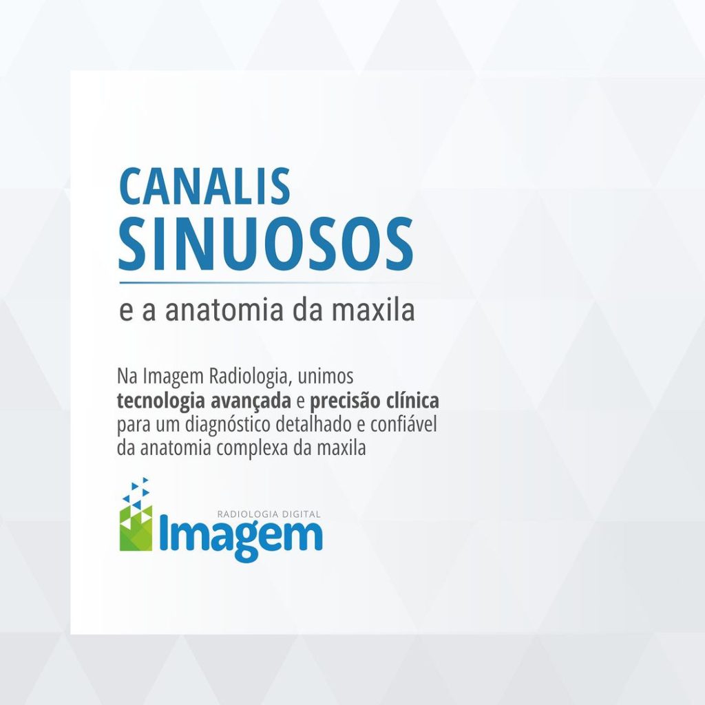 canalis-sinuosos