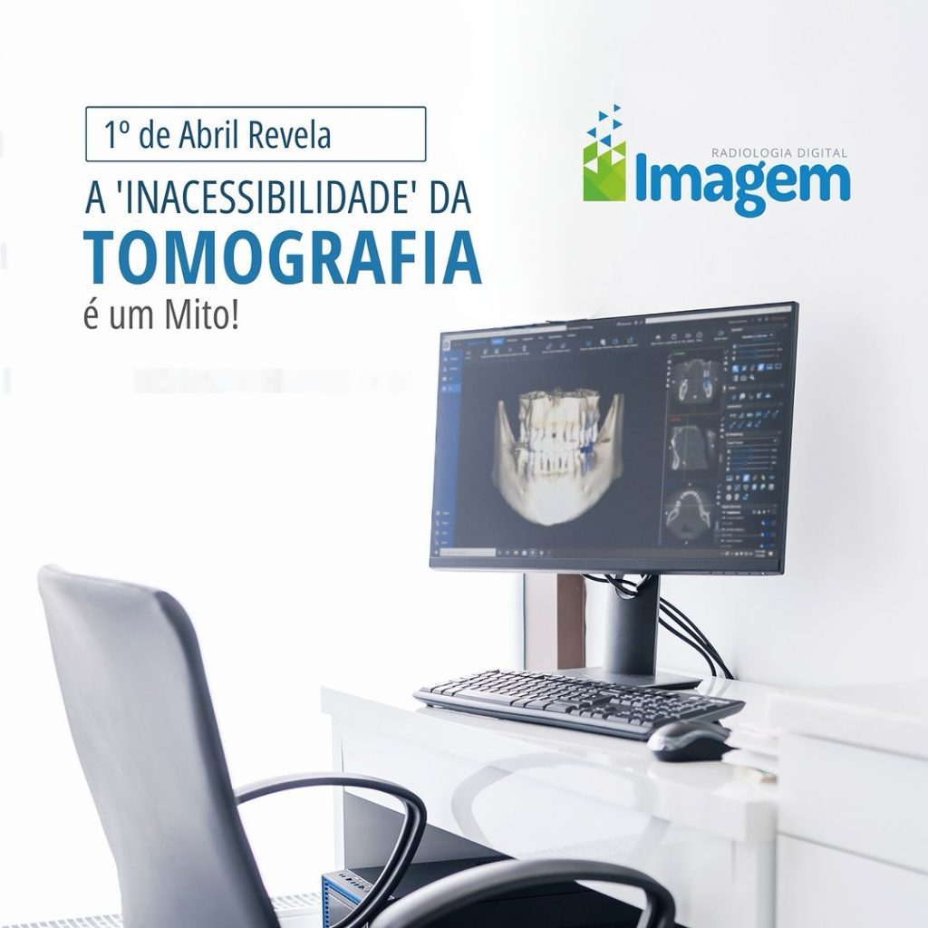 a-inacessibilidade-da-tomografia-e-um-mito