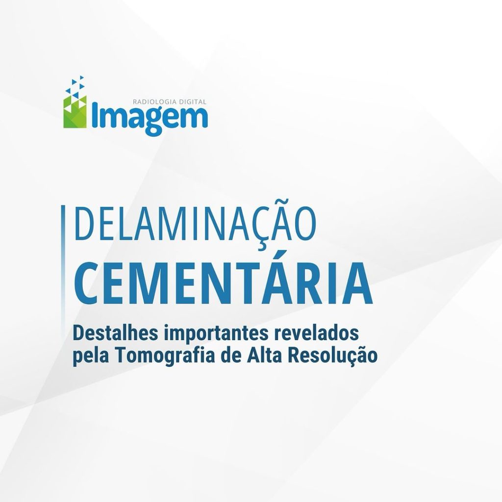 delaminacao-cementaria